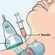 Does a Needle Biopsy in the Neck Hurt?