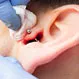 How Bad Does a Cartilage Piercing Hurt?